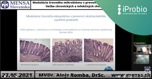 MENSA Slovensko on the role of the microbiome in supporting health and in the prevention of the onset and development of diseases